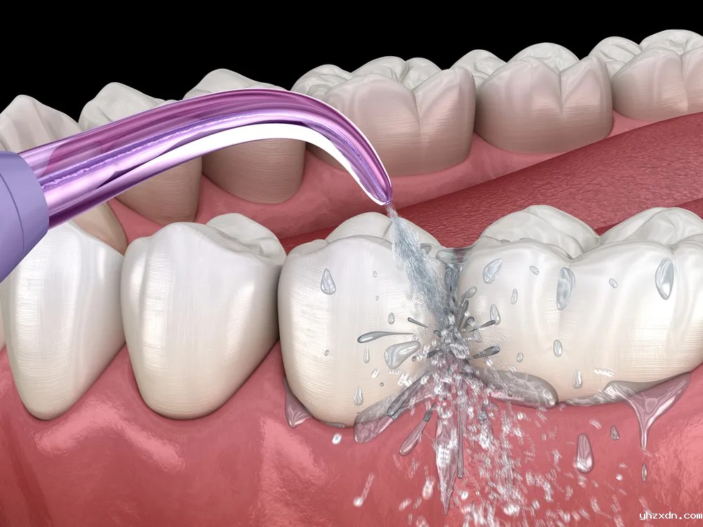 bet必威网址集团_如何守护你的牙周健康