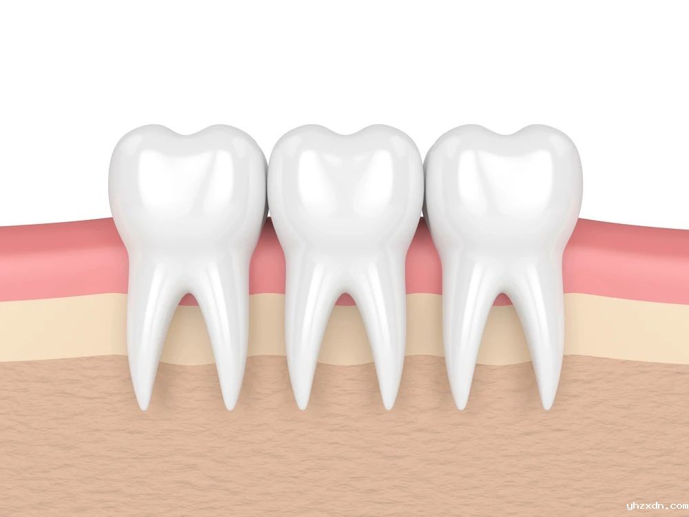 高端牙科诊所：破解牙周病的沉默杀伤链