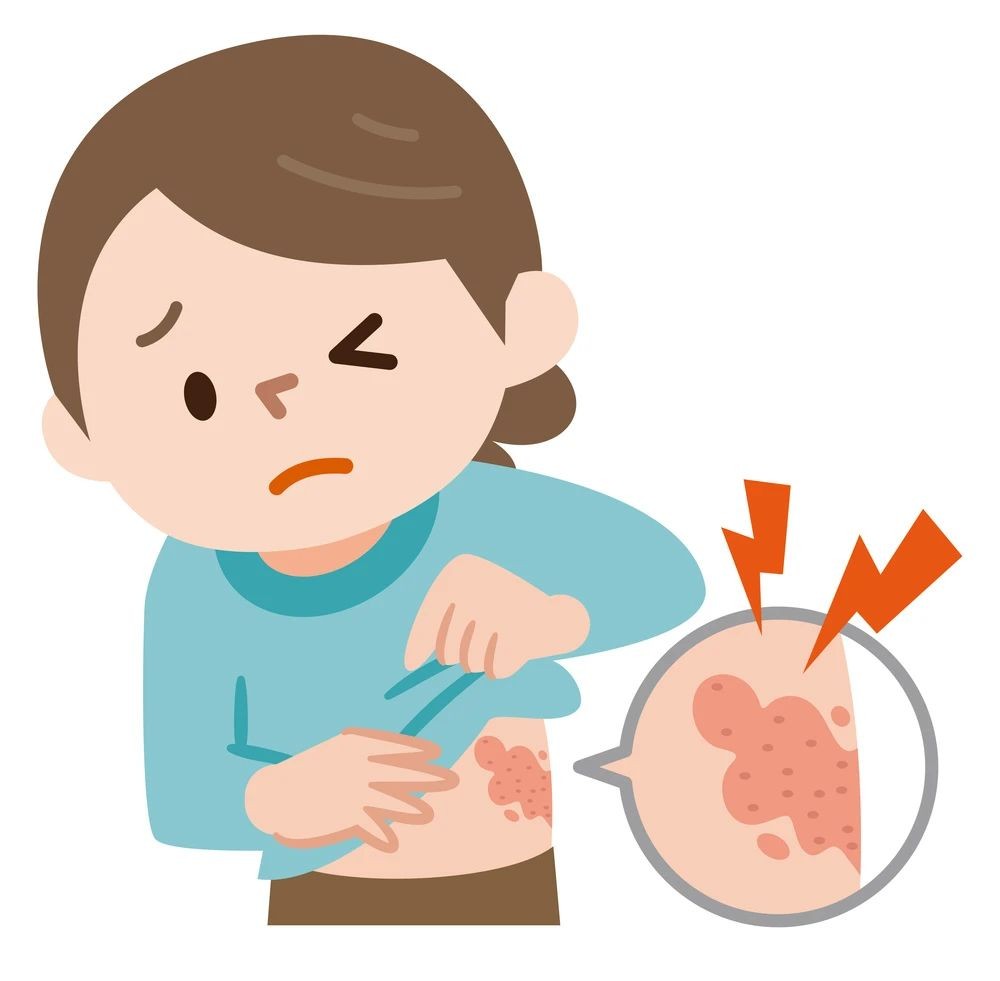 上海高端医院：皮肤在"求救"！带状疱疹的隐秘信号，你读懂了吗？