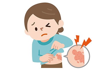 上海高端医院：皮肤在"求救"！带状疱疹的隐秘信号，你读懂了吗？